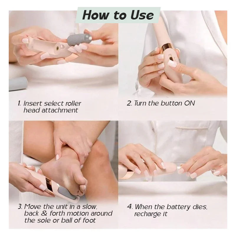SilkySole™ Rechargeable Foot File for Dead Skin & Callus Removal
